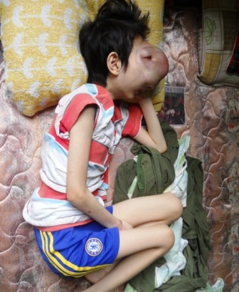 Cậu bé mặc cảm, lầm lũi làm bạn với 4 bức tường.