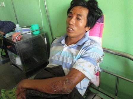 Anh Phạm Văn Bắc thất thần kể lại sự việc.