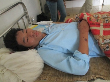 Anh Bùi Hữu Nam với đa vết thương trên cơ thể.