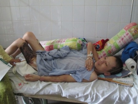  Em Hà vẫn đang trong tình trạng nguy kịch