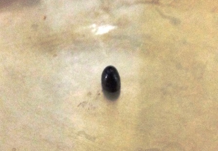 Dị vật được gắp ra từ phế quản của cháu Hào.