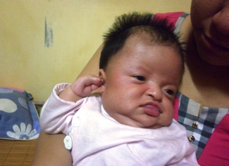 Các ngón tay của bé dính chặt vào nhau, đầu nhô ra...