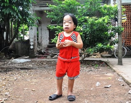 18 tuổi nhưng Loan chỉ cao gần 80cm, nặng 22kg.