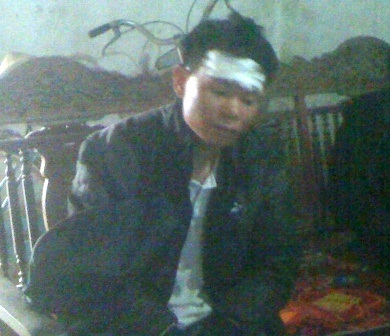 Anh Sơn vẫn chưa hết hoảng hốt khi kể lại sự việc.