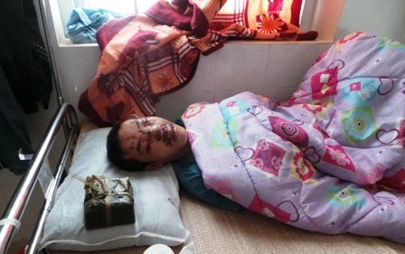 Em Vũ Đình Minh, quê ở huyện Nga Sơn năm nay phải ăn tết tại bệnh viện vì tai nạn giao thông.