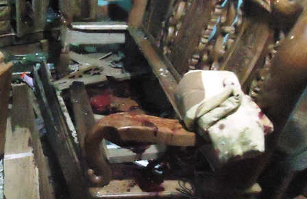 Hiện trường vụ nổ đài cát-xét.