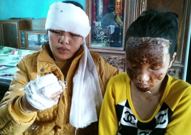 Vụ nổ đài cát-xét: Quyết tìm ra hung thủ trước Tết - 1 Vụ nổ khiến người chồng tử vong còn vợ và con gái bị thương nặng.