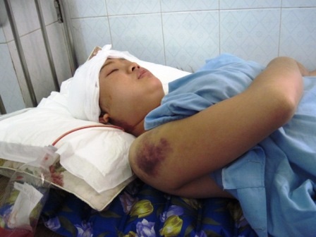 Sau thời gian được bác sỹ điều trị, sức khỏe chị M đã tiến triển tốt.