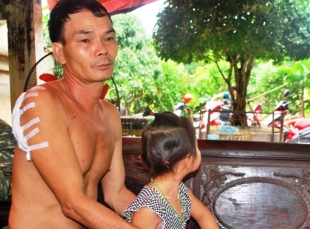 Hai anh em cùng chém hàng xóm, 1 người chết 2 người bị thương