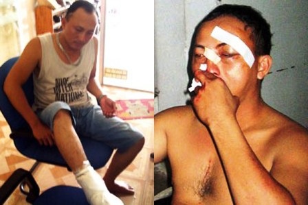 Nỗi lòng “Hiệp sĩ đường phố” - 2 Nỗi lòng “Hiệp sĩ đường phố” - 2