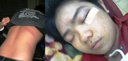 Bị bảo vệ đánh, một học sinh không thể dự thi tốt nghiệp - 2 Bị bảo vệ đánh, một học sinh không thể dự thi tốt nghiệp - 2