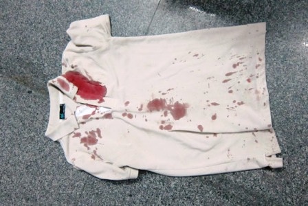 Một thanh niên gãy sống mũi sau khi va chạm với CSGT - 2