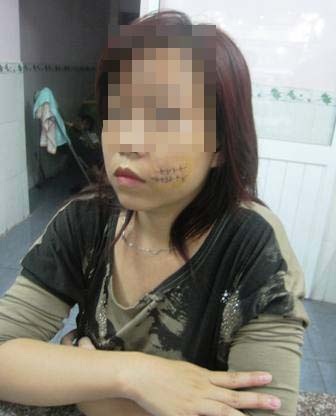 Nghi án một thiếu nữ bị rạch mặt vì tình - 1