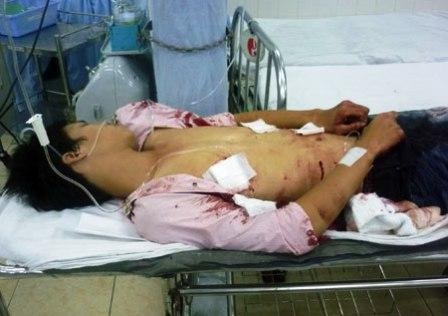 Án mạng nghiêm trọng làm 2 người chết, 2 người trọng thương - 1