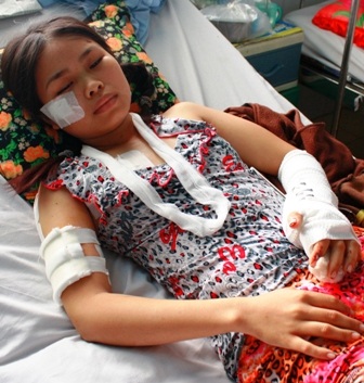 Cô gái trẻ bị chồng cũ chém, cắt gân tay - 1