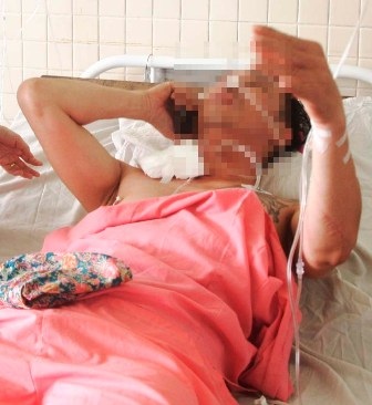 Anh Tuấn bị bắn xuyên cổ được đưa vào cấp cứu tại bệnh viện Chợ Rẫy