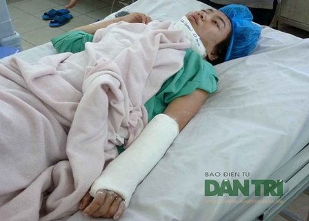 Chị Duyên chấn thương nặng sau vụ bị cướp giật.