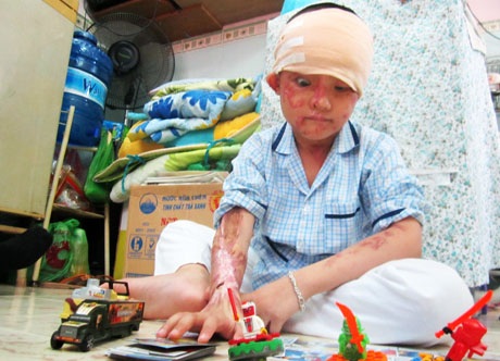 Bé Bảo mới 5 tuổi nhưng phải chịu những thương tật kinh hoàng