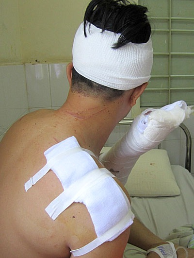 Anh An với những vết thương nghiêm trọng trên người