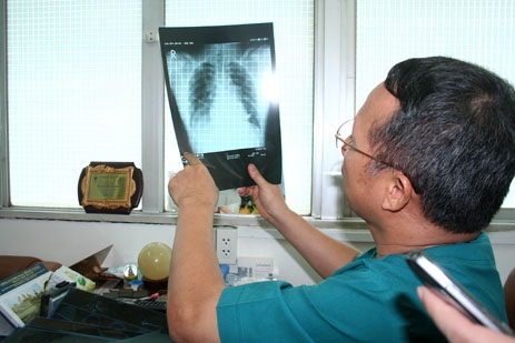 Hình ảnh ghi nhận bệnh nhân Chiến bị áp xe trung thất do thủng thực quản