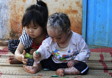 Cuộc sống lay lắt của bé 14 tháng tuổi mở mắt khi ngủ - 1 Mới hơn 3 tuổi nhưng bé Như Tâm rất thương em trai và luôn chơi cùng em để bố mẹ đi làm