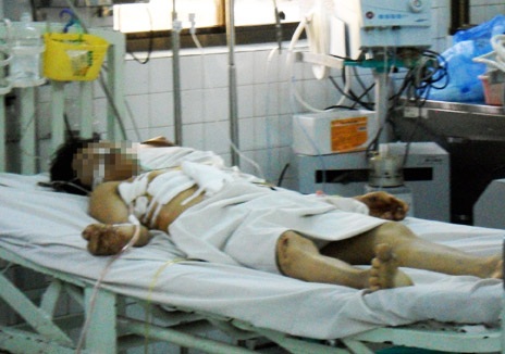 Nghi can Đ. đang được điều trị tại bệnh viện