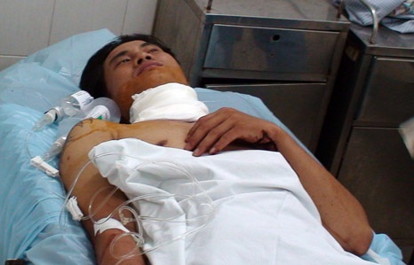 Truy tìm "sát thủ" cắt cổ 2 phụ huynh đang đón con trước cổng trường - 2 Anh Phúc đang được điều trị tại bệnh viện