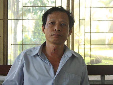 Những vụ án kinh hoàng khó tưởng do “sát thủ” axit gây ra - 3 Một đối tượng dùng axit tạt vào cả gia đình hàng xóm bị bắt giữ