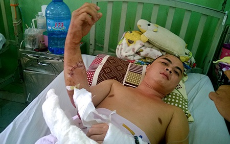 Truy sát trong quán thịt chó, 5 người trọng thương - 2 Anh Trọng bị chém nhiều nhát vào đầu, tay