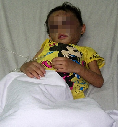 Bé N. được cấp cứu tại bệnh viện