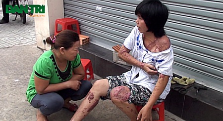 Nhiều người không khỏi xót xa trước cảnh sống không bằng chết của chị Loan