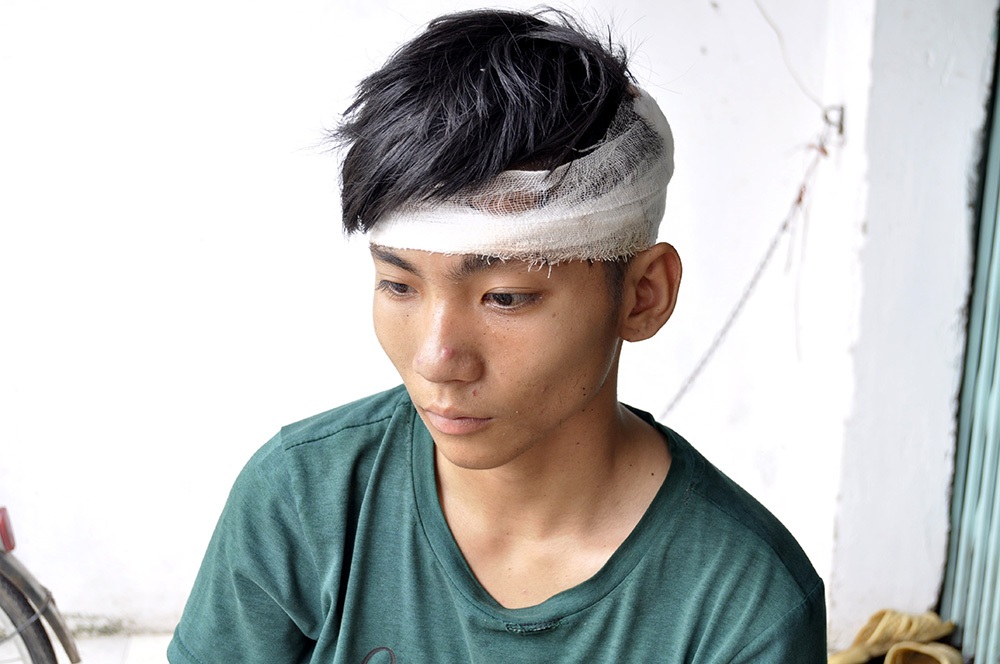 Xác định nhóm côn đồ xông vào UBND phường chém gục một thanh niên - 2 Nạn nhân Nguyễn Văn Quang vẫn chưa hết bàng hoàng sau khi bị truy sát vào tận UBND phường