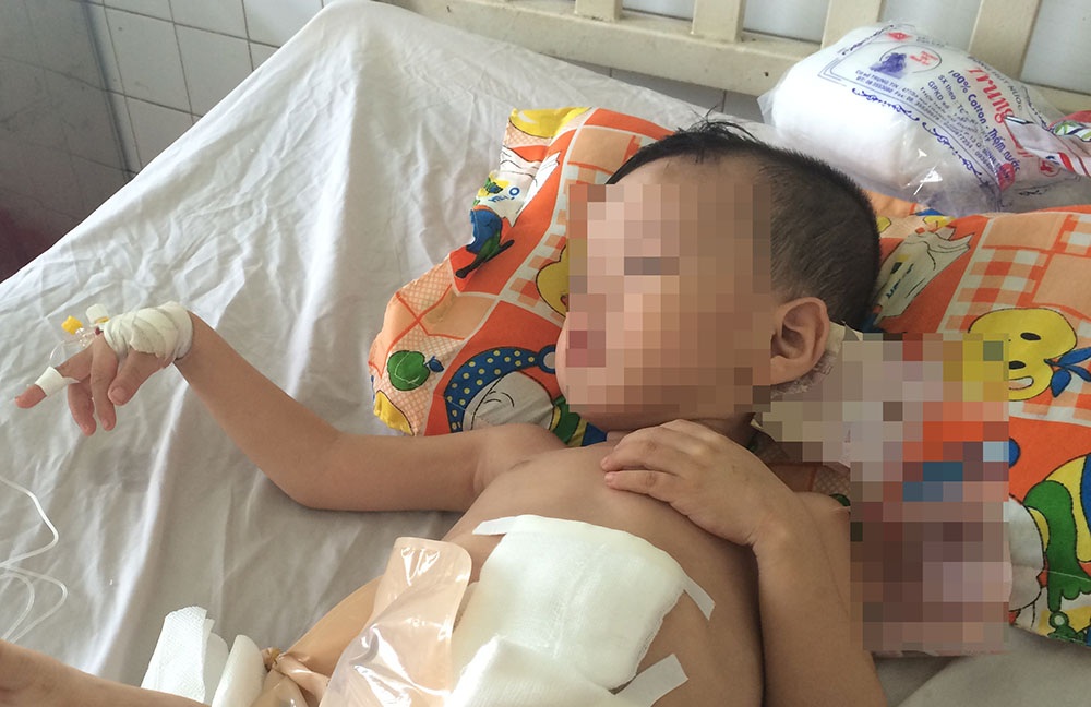 Bé 3 tuổi bị người tình của mẹ đạp vỡ đại tràng - 1 Bé H. đang được điều trị tại bệnh viện Đa khoa tỉnh Bình Dương