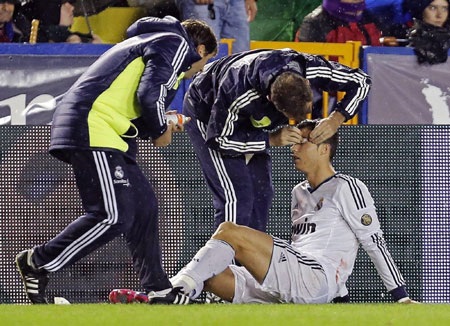C. Ronaldo đổ máu vì lĩnh đòn của “đồ tể” David Navarro - 1 C.Ronaldo đã có bàn thắng đầu tiên tại Ciutat de Valencia nhưng cũng phải trả cái giá đắt