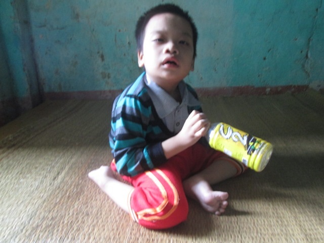 Bé Ngọc Minh 9 tuổi nhưng chỉ như một cậu bé lên 3