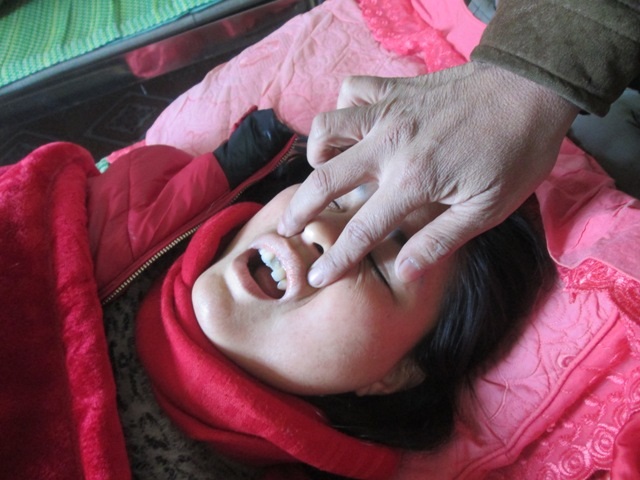 Chị Thủy đang nằm viện với khuôn mặt bầm dập, gãy nửa chiếc răng