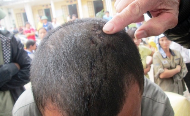 Nhiều nạn nhân bị nhóm người đánh đập khắp đầu và cơ thể đến bất tỉnh