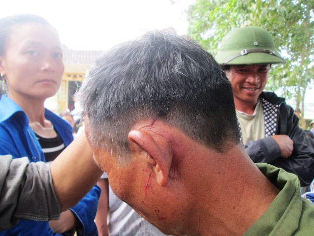 Người già, phụ nữ xã Yên Lạc bị hành hung vô tội vạ