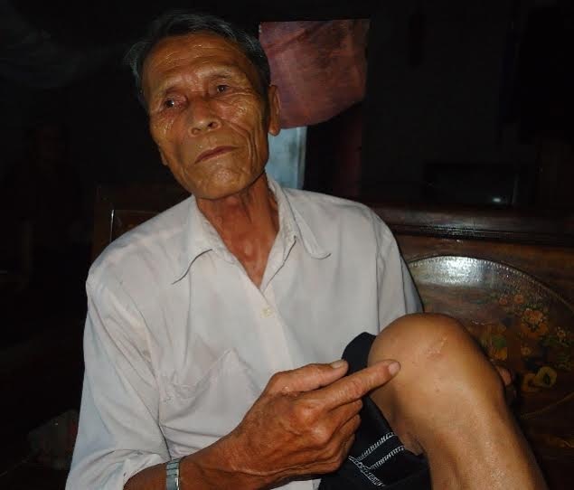 Cụ Chấn và vết thương trong trận chiến năm ấy