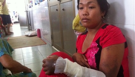 Cha tưới xăng lên người con 8 tuổi rồi cùng tự thiêu - 1 Chị Nhung kể lại vụ việc với phóng viên.