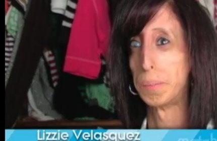 Video cảm động của một bà mẹ có con không mắt