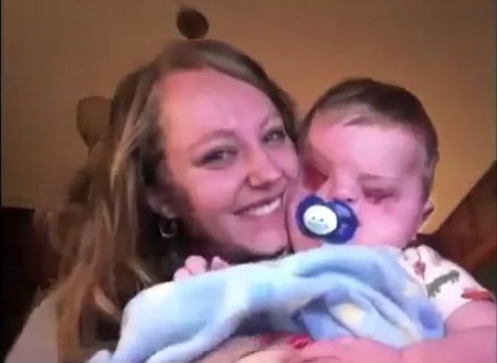 Video cảm động của một bà mẹ có con không mắt