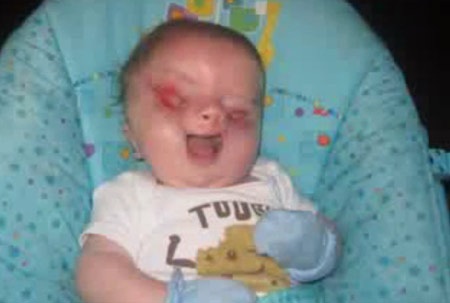 Video cảm động của một bà mẹ có con không mắt