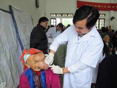 Khối u quái khổng lồ “bít” nửa mặt cụ bà 90 tuổi - 3 Bác sĩ thăm khám, tư vấn cho cụ Chài cách chăm sóc điều trị khối u