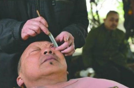 Rùng mình với thú "cạo mắt” ở Trung Quốc - 1 Liu Deyuan đã hành nghề cạo mắt từ năm ông 17 tuổi.