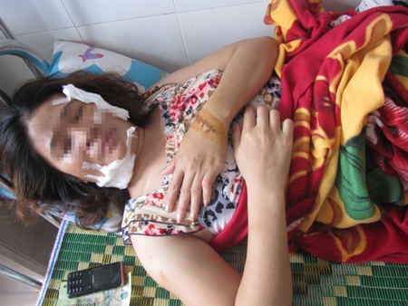 Dùng dao cứa cổ vợ cũ - 1 Dùng dao cứa cổ vợ cũ - 1