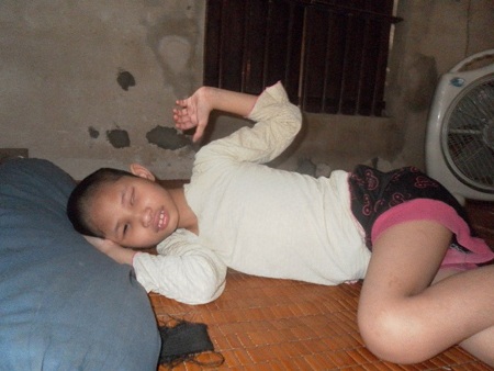 “Phận tui khổ đành chịu, chỉ thương con” - 1 Căn bệnh bại não khiến Nguyễn Thị Hường bị mù 2 mắt, không thể tự vận động được