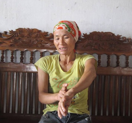 Láng giếng mất tình nghĩa vì... 10 nghìn đồng - 1 Bà Nguyễn Thị Tứ và cánh tay gãy vẫn còn đau sau 1 năm xảy ra vụ việc
