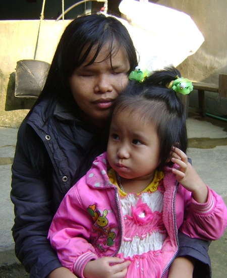 Hành trình tìm ánh sáng của đôi vợ chồng mù - 4 Hành trình tìm ánh sáng của đôi vợ chồng mù - 4