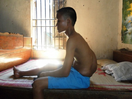 “Con đau lắm mẹ ơi, cố cho con đi viện đi” - 1 16 năm qua, Vương Trung Nhân phải sống trong đau đớn bởi khối u máu ngay cột sống
